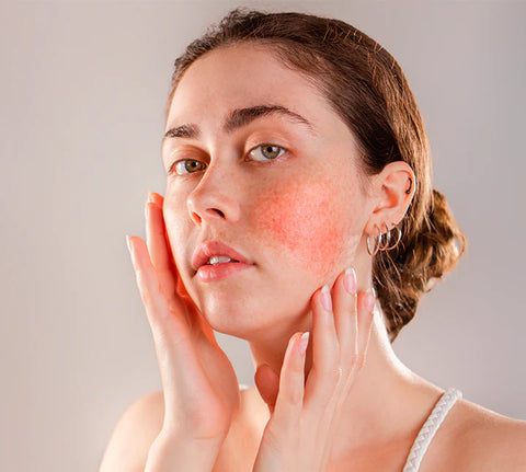 Starmask 4 Sensitive 500 gram